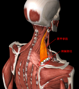 首から背中にかけての痛み トリガーポイント療法専門 もりかわ鍼灸治療院