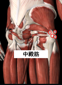 転倒後のお尻の痛み トリガーポイント療法専門 もりかわ鍼灸治療院
