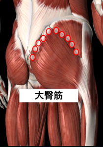 転倒後のお尻の痛み トリガーポイント療法専門 もりかわ鍼灸治療院