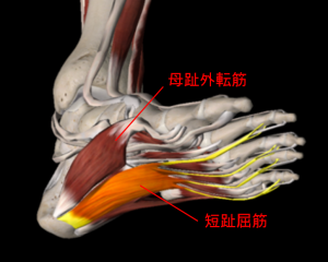 足裏の痛み 足底筋膜炎 トリガーポイント療法専門 もりかわ鍼灸治療院
