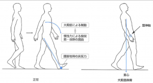 大殿 筋 歩行