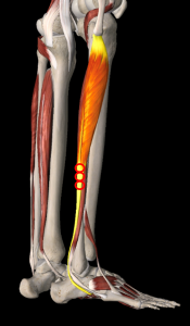 長腓骨筋トリガーポイント