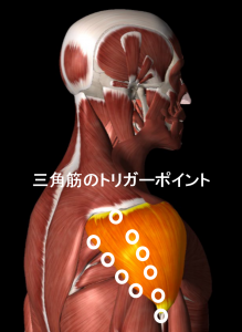 三角筋のトリガーポイント