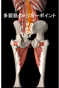 多裂筋のトリガーポイント