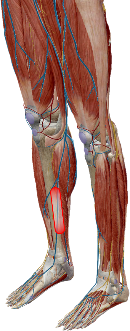 スポーツで生じる疾患に対する鍼治療 | トリガーポイント療法専門 もり